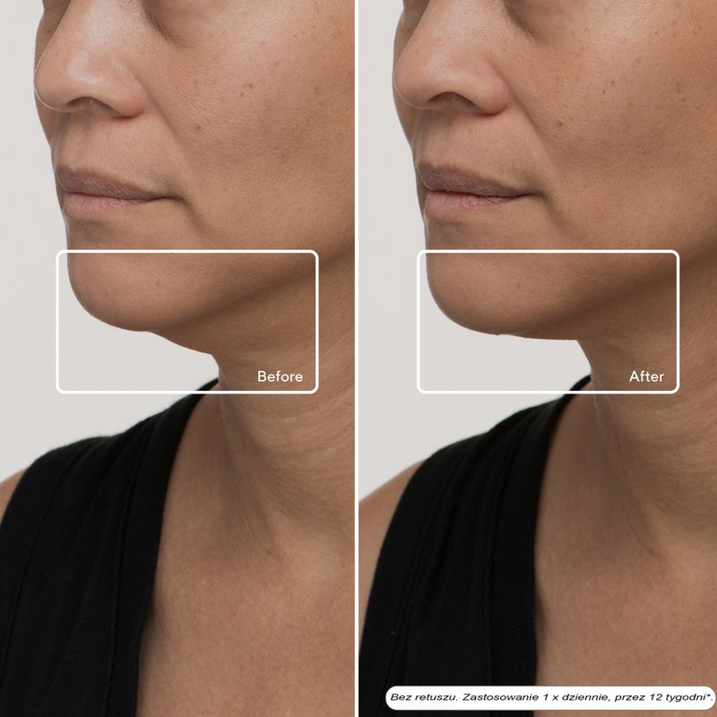 Maschera LED per il viso Therabody TheraFace LED Mask 9