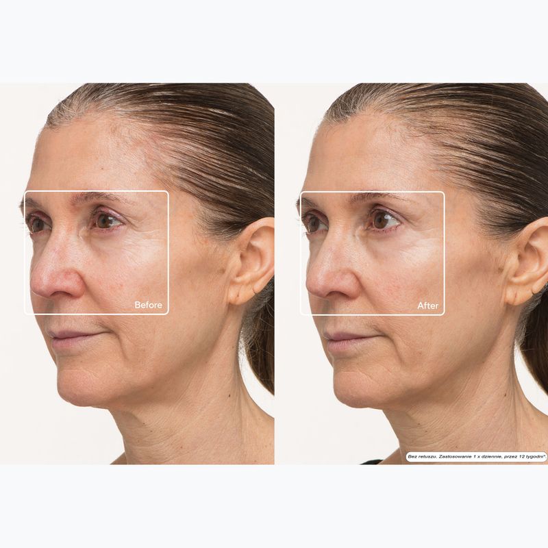 Maschera LED per il viso Therabody TheraFace LED Mask 10