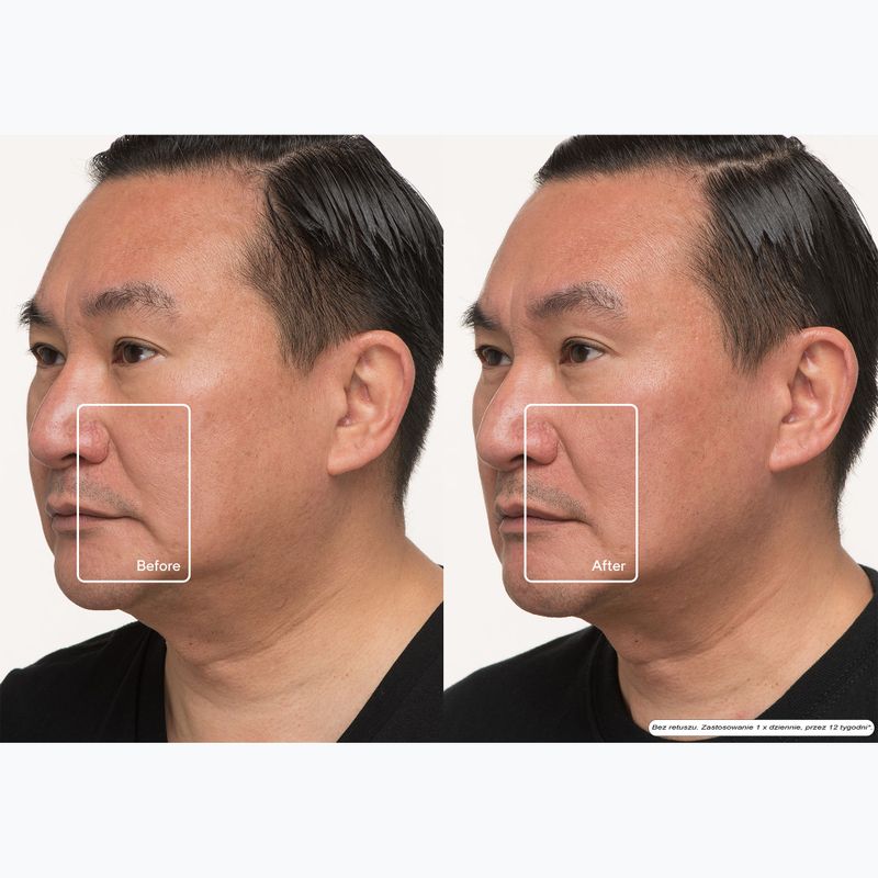 Maschera LED per il viso Therabody TheraFace LED Mask 12