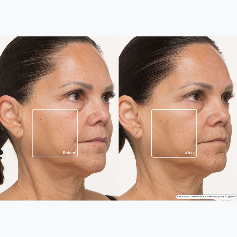 Maschera LED per il viso Therabody TheraFace LED Mask 13